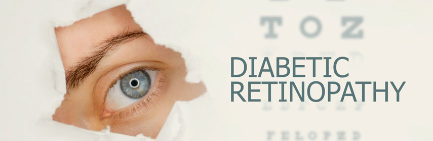 Risk factors of Diabetic Retinopathy
